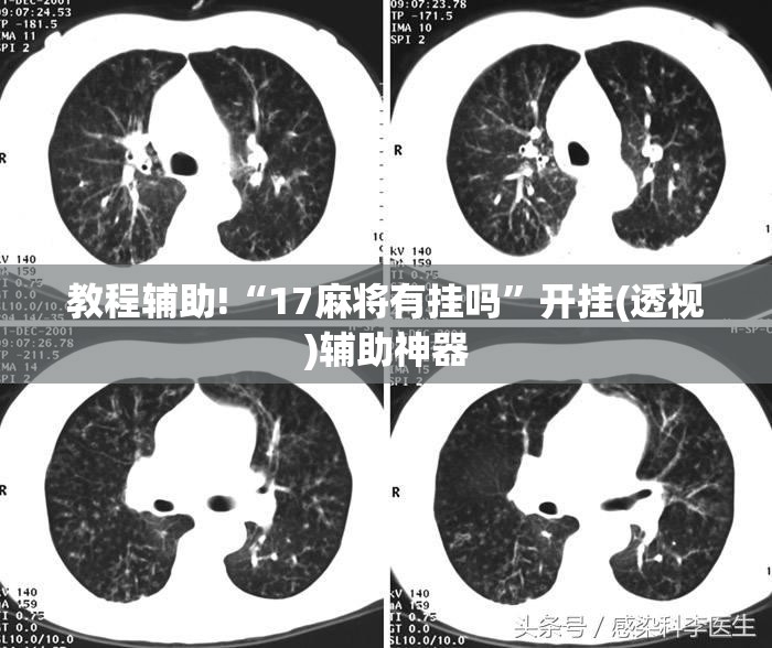 教程辅助!“17麻将有挂吗”开挂(透视)辅助神器