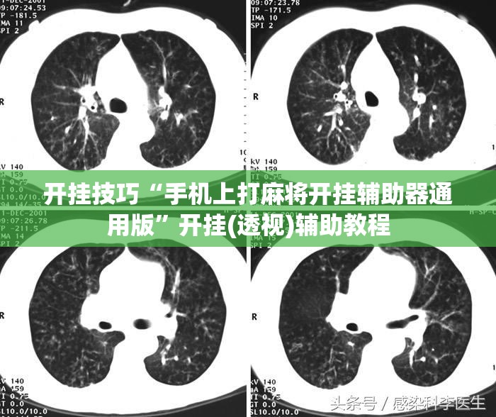 开挂技巧“手机上打麻将开挂辅助器通用版	”开挂(透视)辅助教程