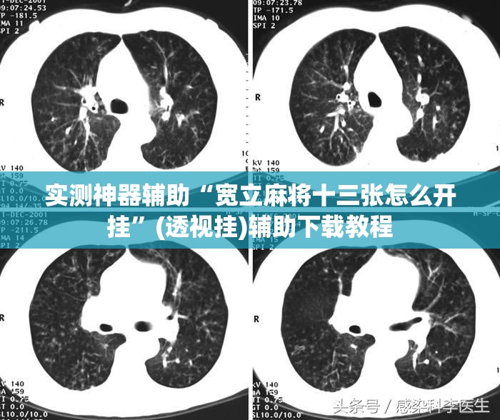 实测神器辅助“宽立麻将十三张怎么开挂”(透视挂)辅助下载教程
